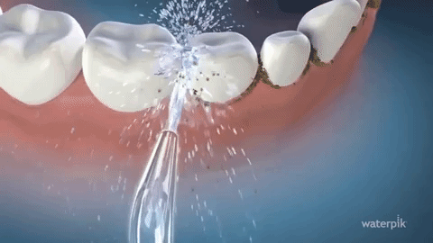 video gif of water flossing